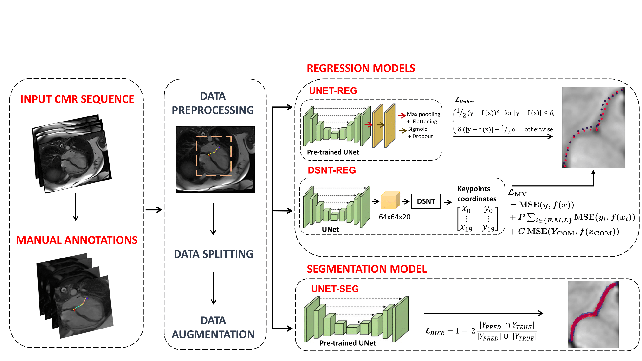 DeepValve detection pipeline diagram
